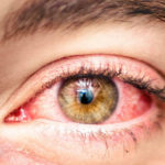 οφθαλμικές αλλεργίες